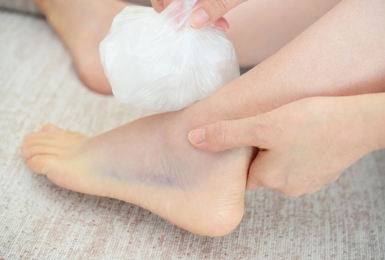 Bong gân và chấn thương cổ chân khi chơi pickleball - Cách xử lý và phục hồi